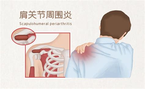 长期戴玉的好处_长期戴玉有什么坏处,第17张